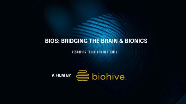 "They'll get this really emotional reaction, often in tears, feeling the world around them. Because for a lot of our patients it's been decades since they've had that sensation."
BioHive had the opportunity to talk with Jacob A. George, Chief Scientist at @biologicinputoutputsystems, about how their Universal Neural Interface can bring movement and feeling back to those with limb loss. π§ π¦Ύ
Watch the video to learn more about how BIOS is working with the University of Utah to engineer breakthroughs in prosthetic limbs.